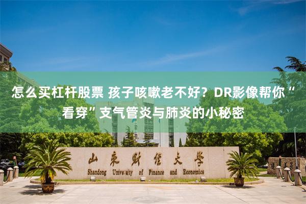 怎么买杠杆股票 孩子咳嗽老不好？DR影像帮你“看穿”支气管炎与肺炎的小秘密